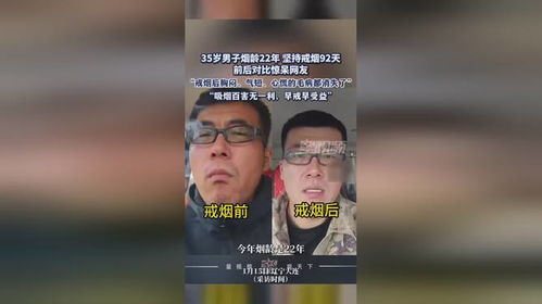 男子烟龄22年坚持戒烟92天前后对比